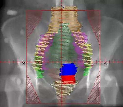 پرتودرمانی