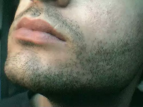 چانه