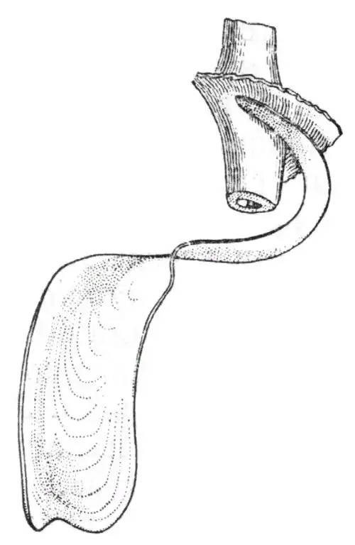 کرکره