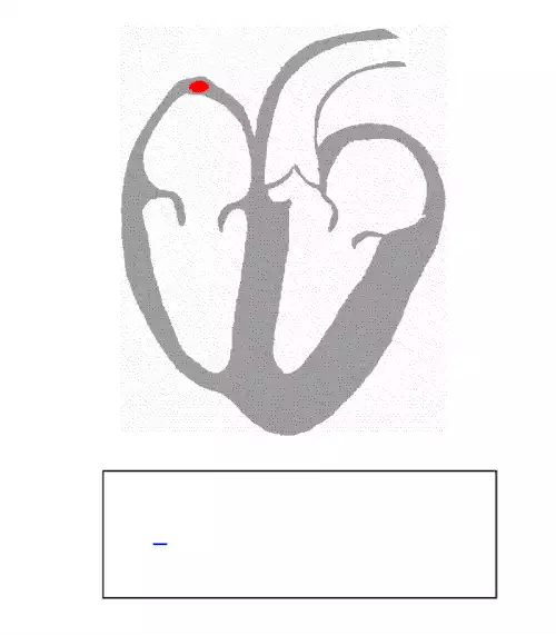 نوار قلب