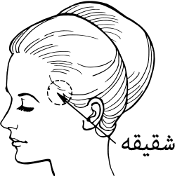 صدغ