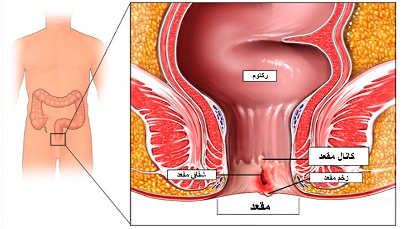 مقعد