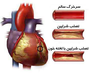 شرائین